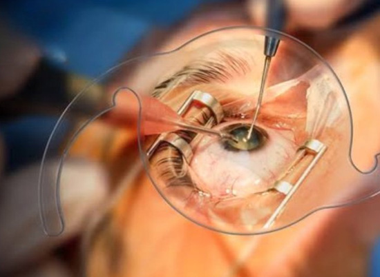 Best Eye Doctor in Goregaon West