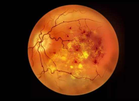 Best Ophthalmologist Eye Doctor in Goregaon