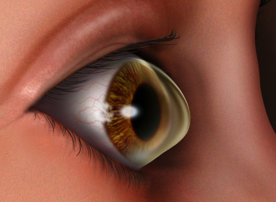 Best Ophthalmologist Eye Doctor in Goregaon