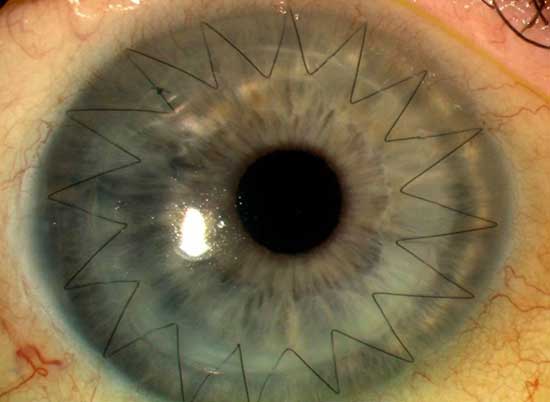 Eye Doctor in Goregaon