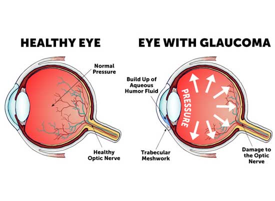 Best Ophthalmologist Eye Doctor in Goregaon