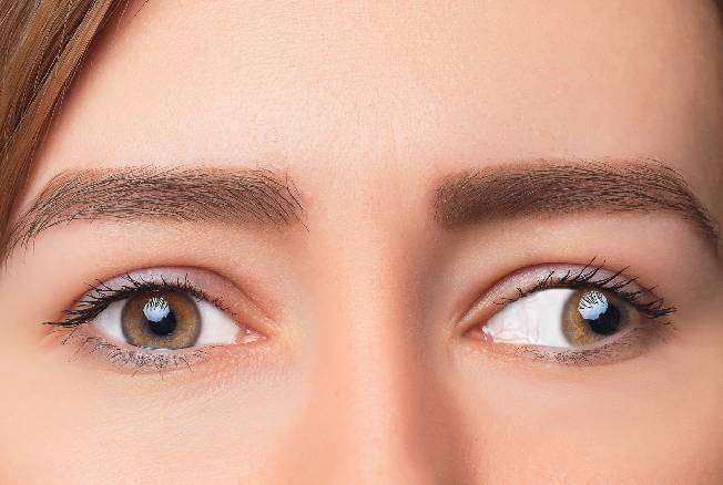 Squint Treatment in Goregaon