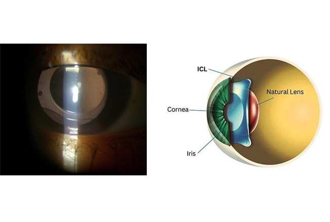 Best Ophthalmologist & Eye Surgeon in Goregaon